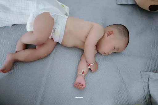 衡东宝宝头上长痱子